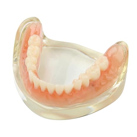 Dental Model Overdenture Inferior 2 Implants Demo Detachable (Lower Jaw)